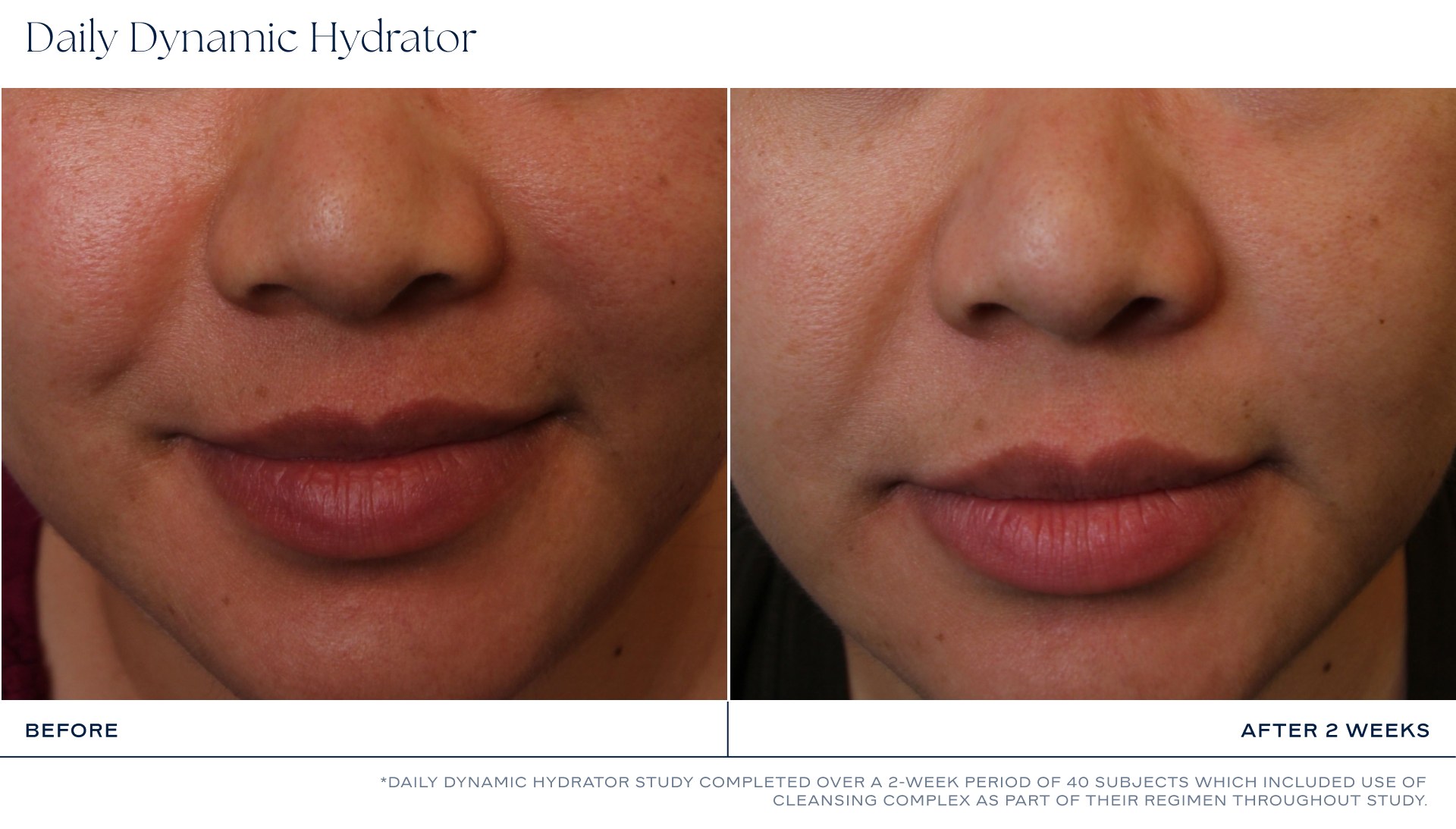 iS Clinical Daily Dynamic Hydrator photo 8