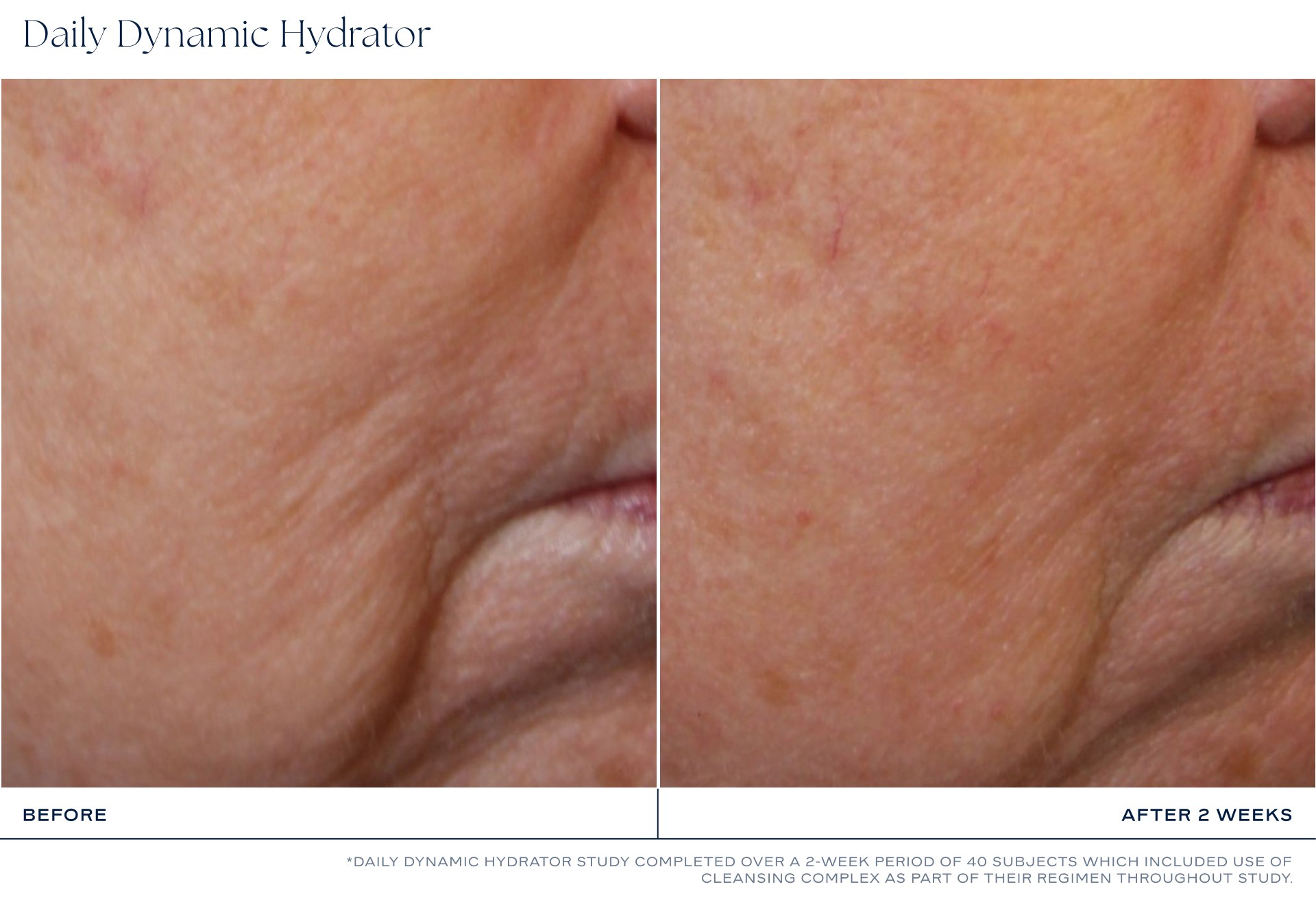 iS Clinical Daily Dynamic Hydrator photo 9
