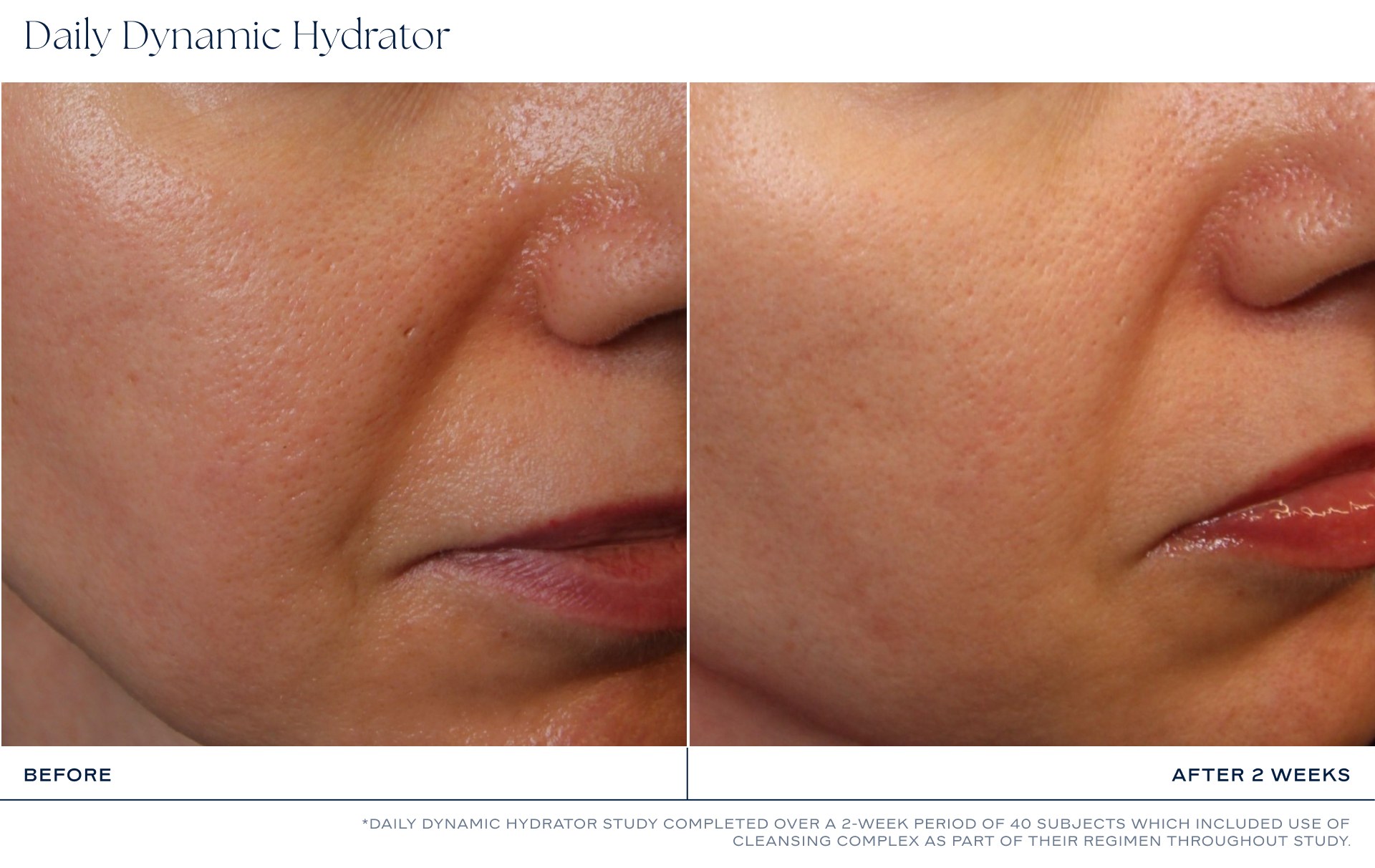 iS Clinical Daily Dynamic Hydrator photo 10
