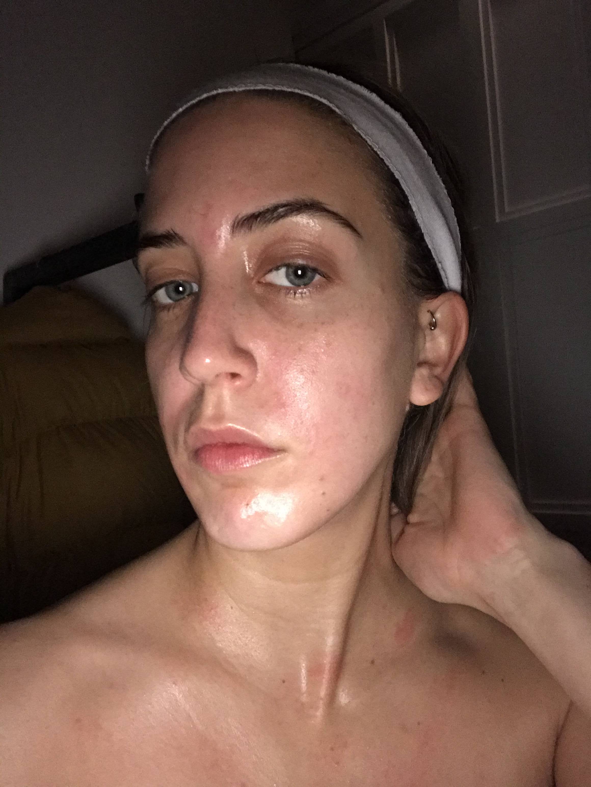Moments after the facial 