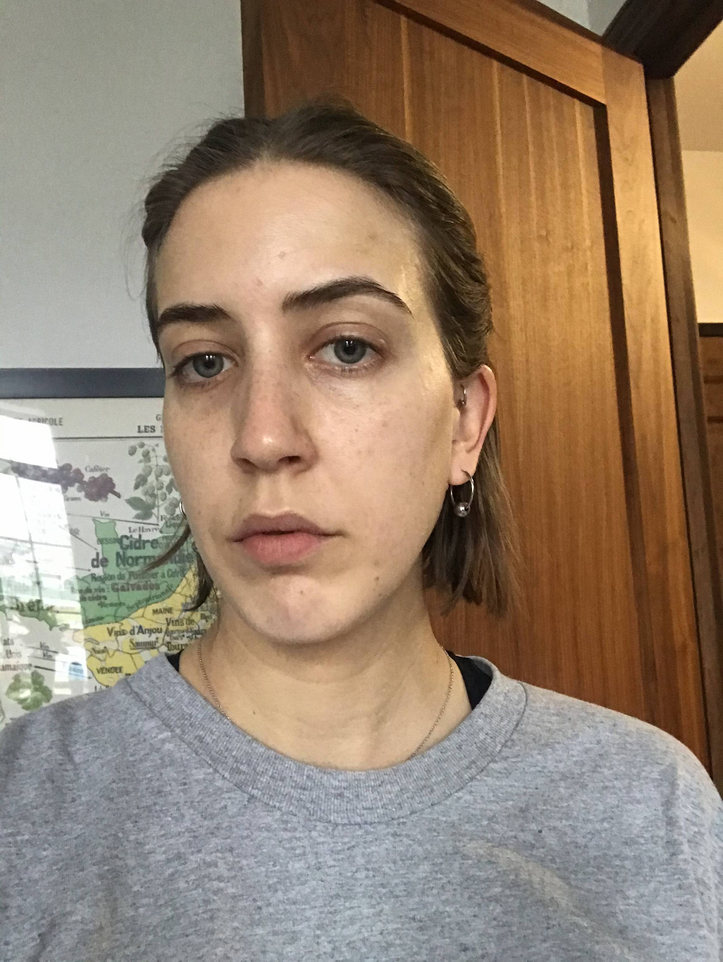 Before the P50 facial