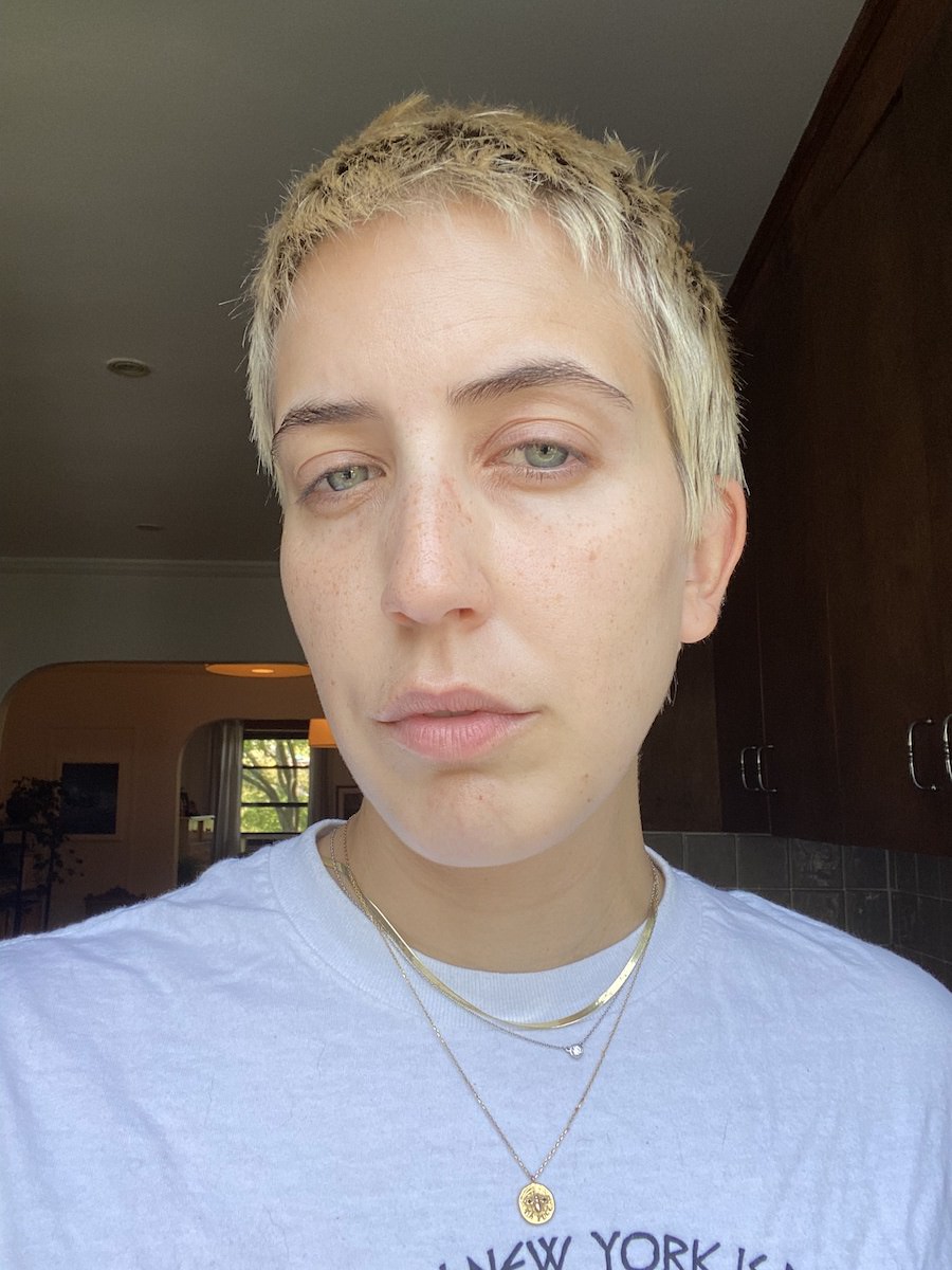 BEFORE: Sleepy and sullen skin