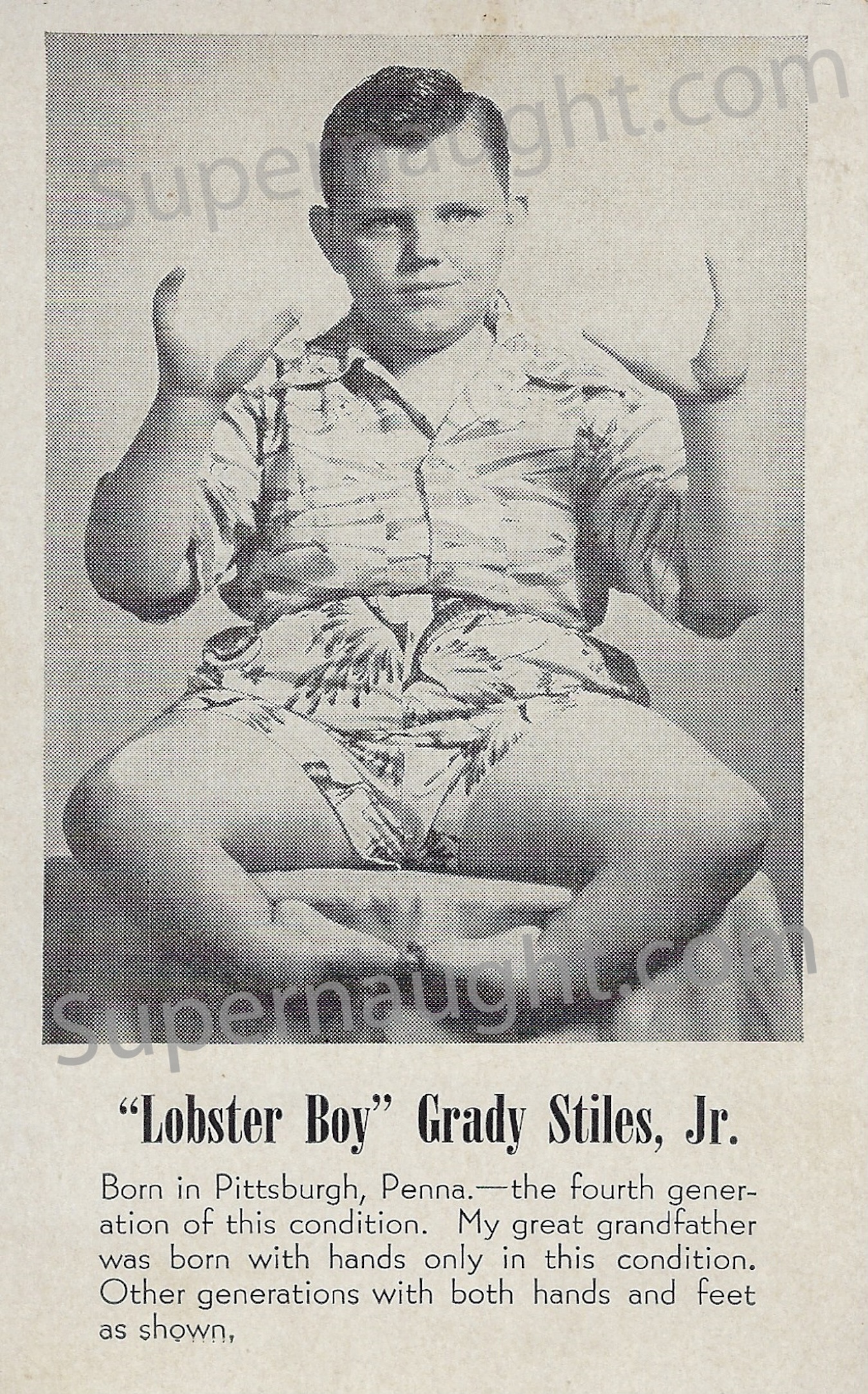 Grady Stiles Jr. Lobster Boy Signed Sideshow Pitch Card