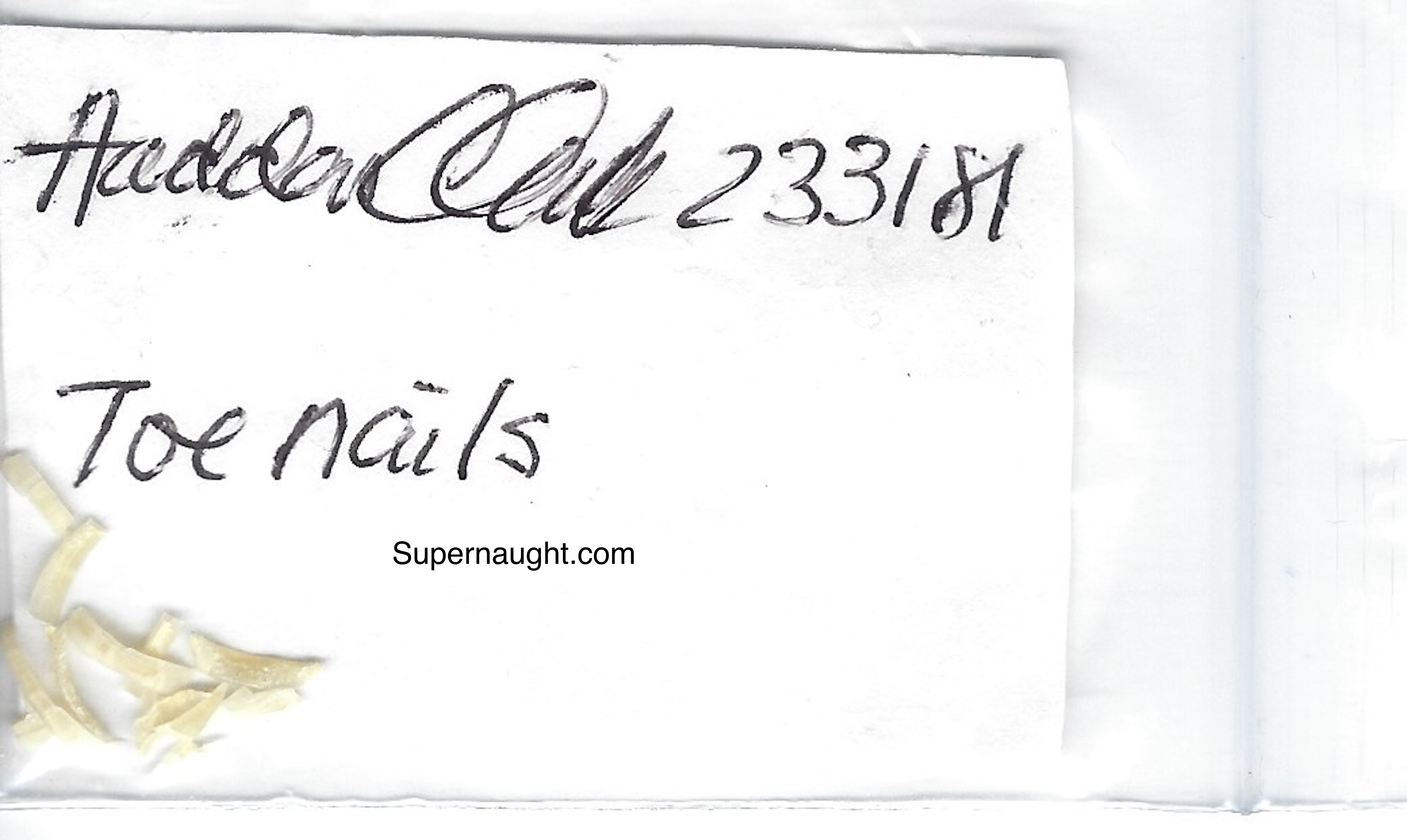 Hadden Clark Signed Toe Nail Clippings