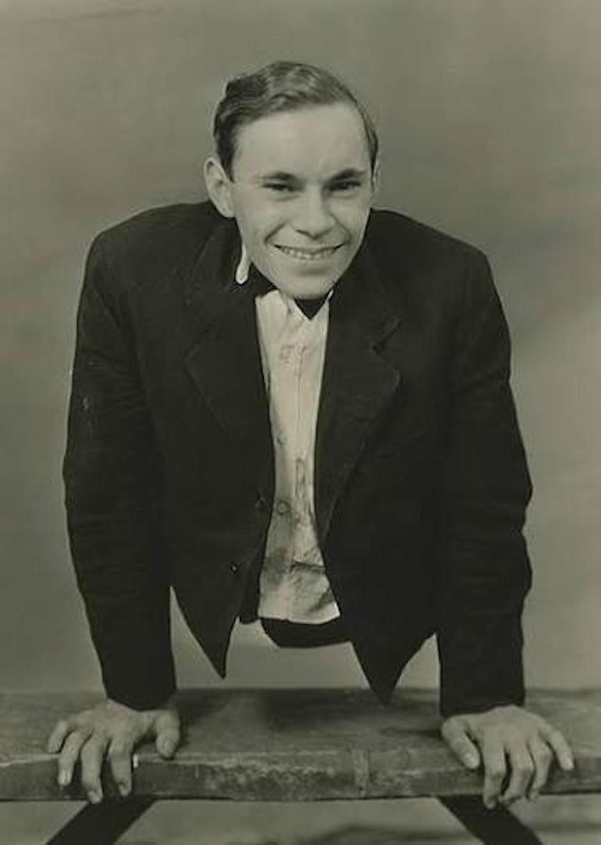 Johnny Eck