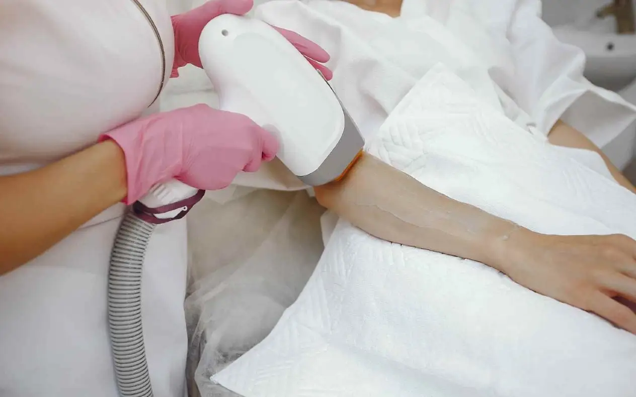 Laser za dlačice Laser za uklanjanje dlačica