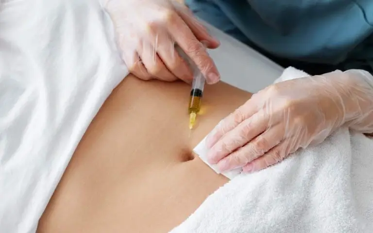 Ubrizgavanje tečenosti Lipoliza, ubrizgavanje tečnosti i masne naslage