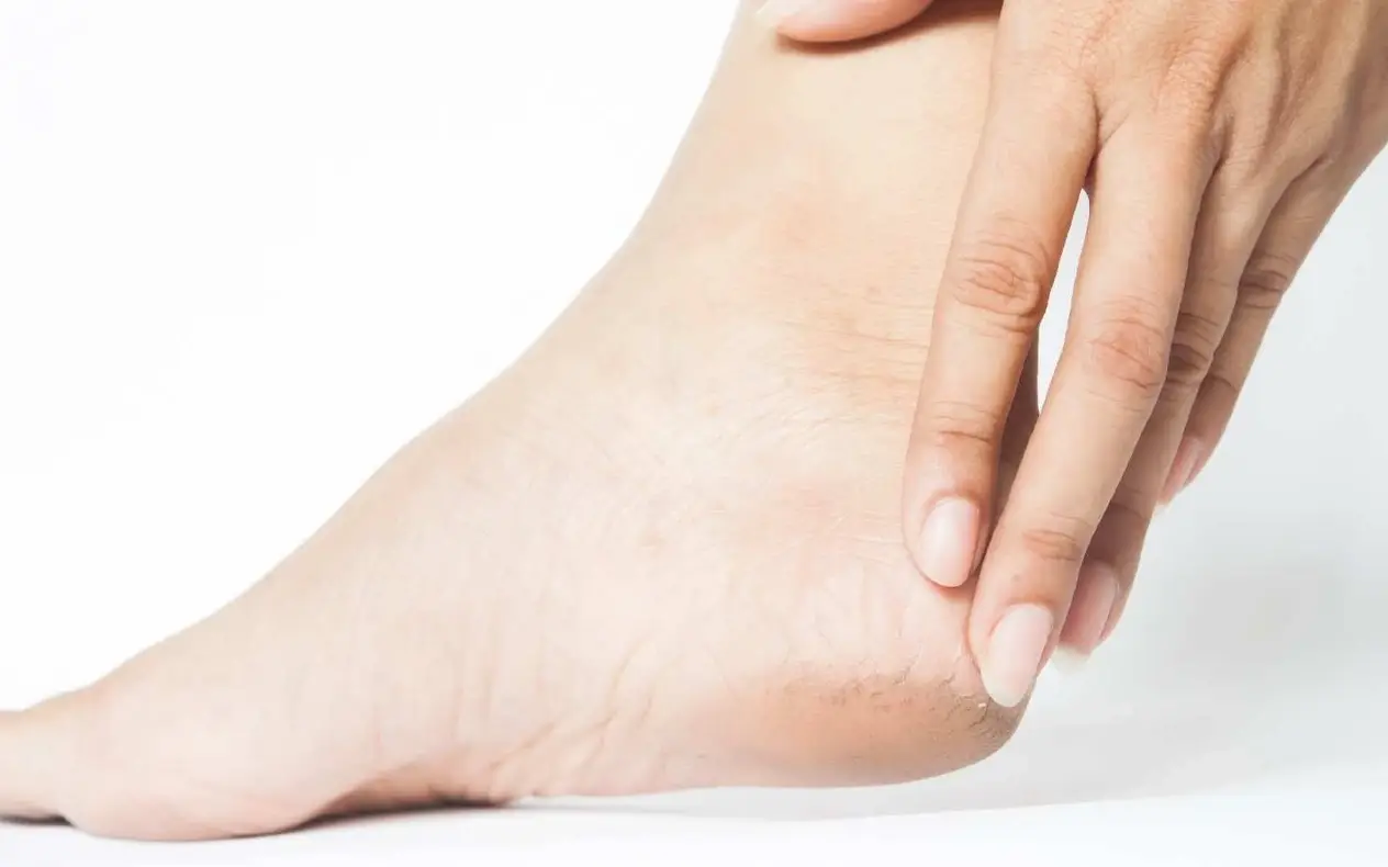 Nega stopala na prirodan način