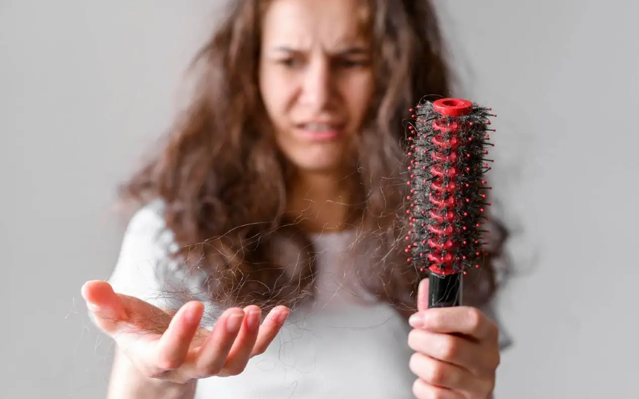 Opadanje kose nije uvek od stresa: Lekari upozoravaju na skriveni uzrok