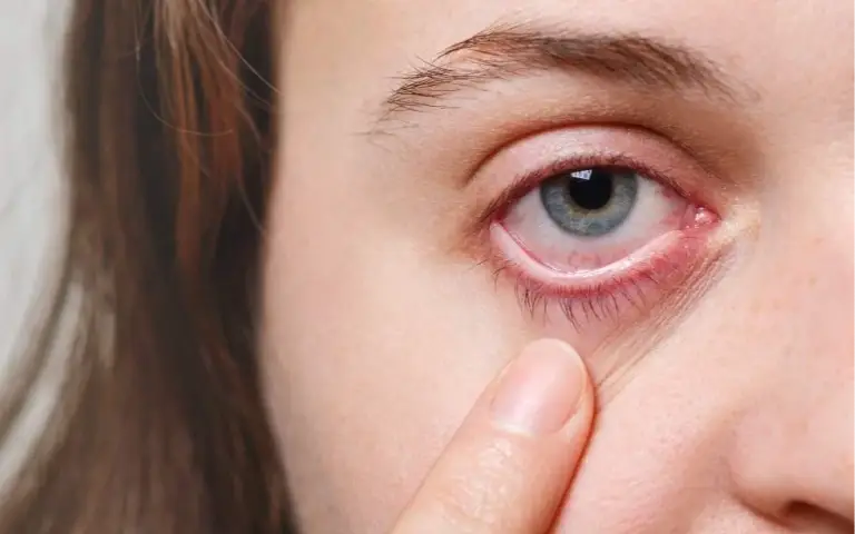 Trepavice kao znak bolesti organizma