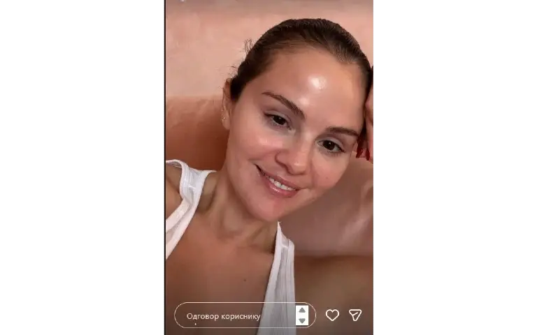 Selena Gomez u potpuno prirodnom izdanju bez šminke