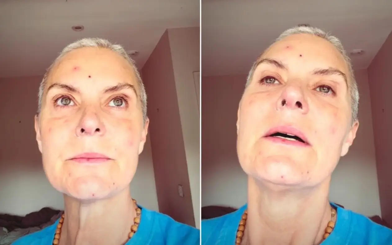 Zvezda serije "Coronation Street" Tracy Shaw hitno hospitalizovana nakon hemoterapije