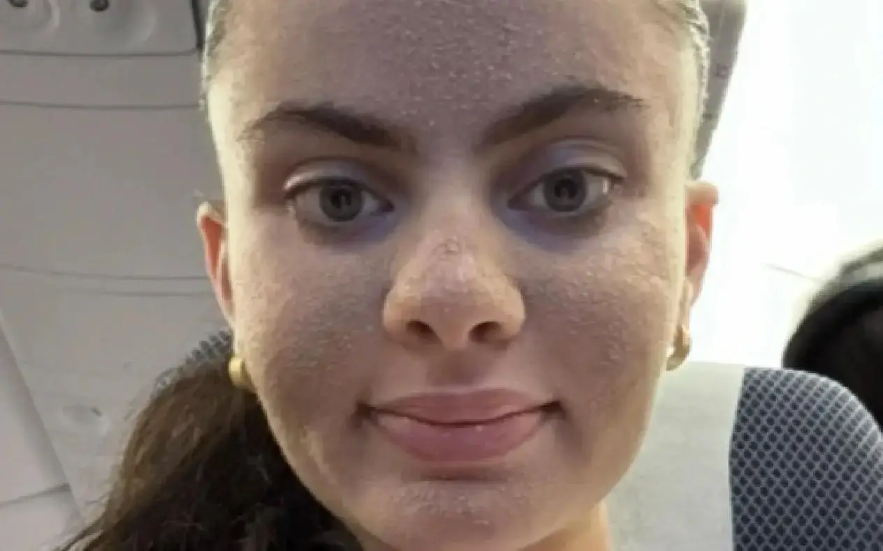 Viral na TikToku: Influenserka šokirala svet  – prestala je da pere lice, a evo kako sada izgleda