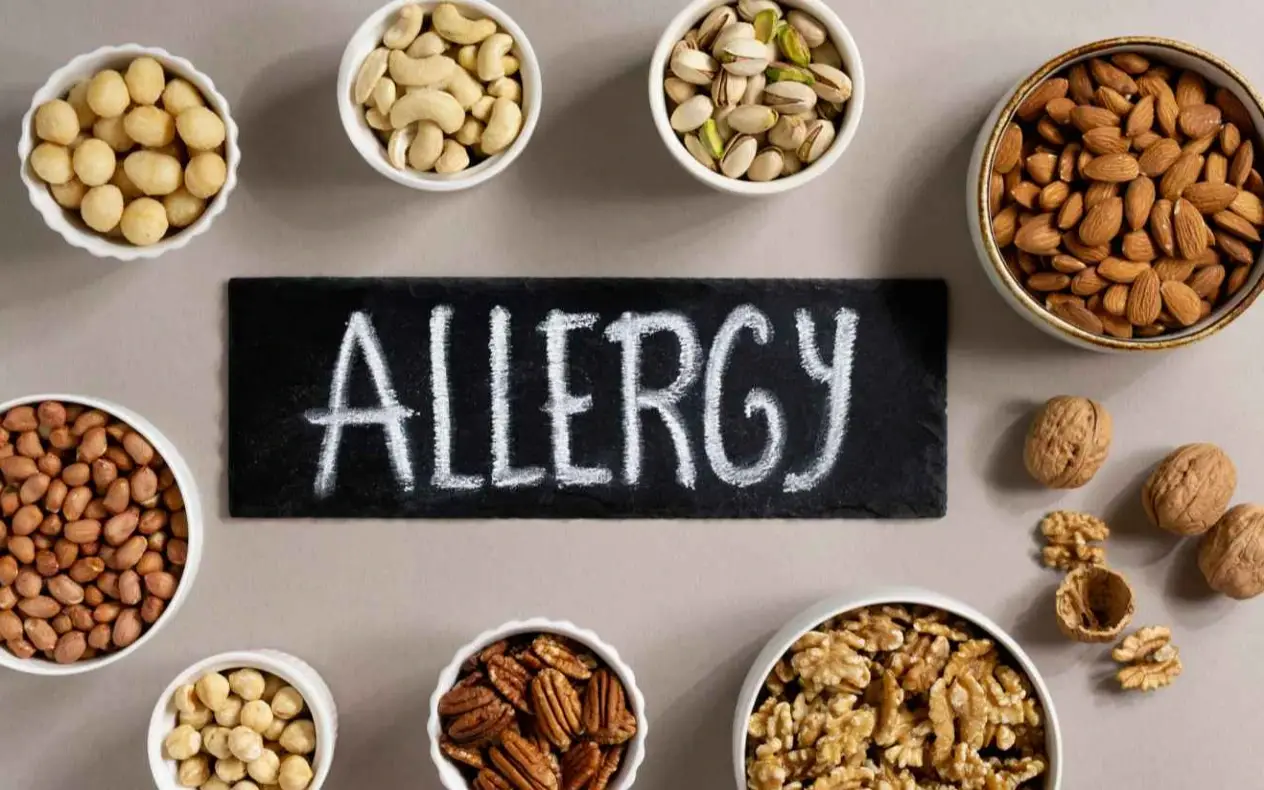 Hrana koja izaziva alergiju