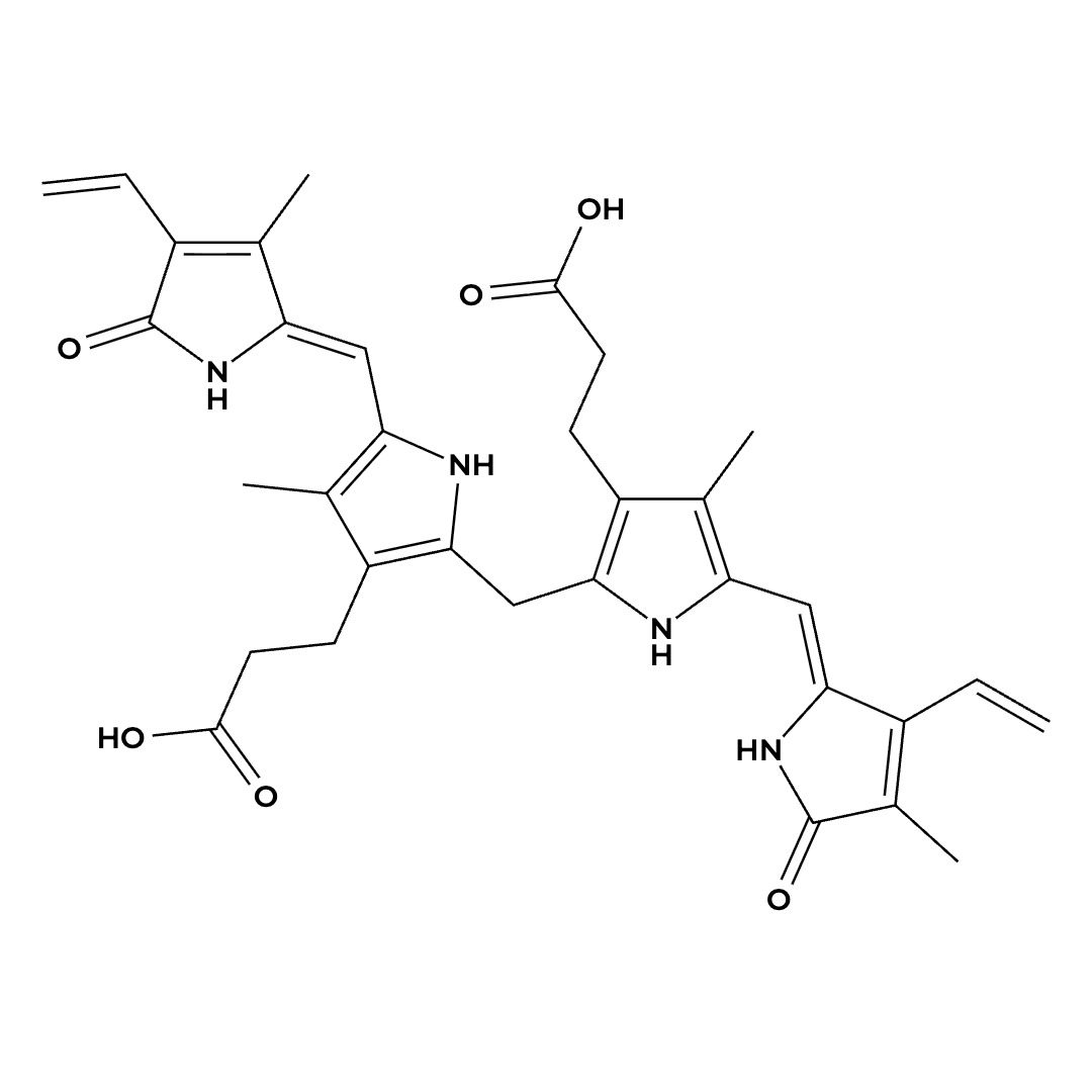 Bilirubin Bilirubin