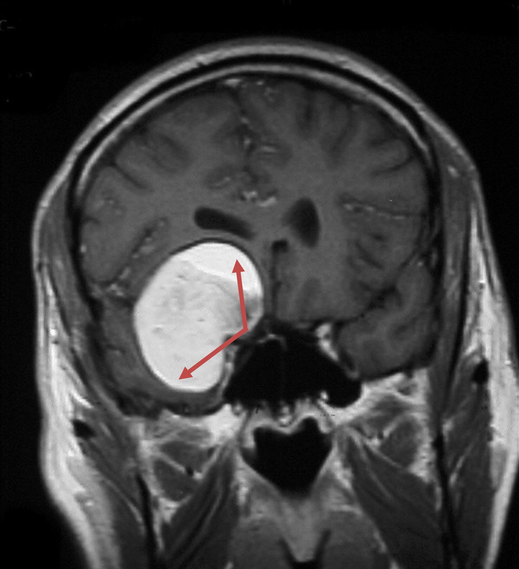 Medical Artifact Image