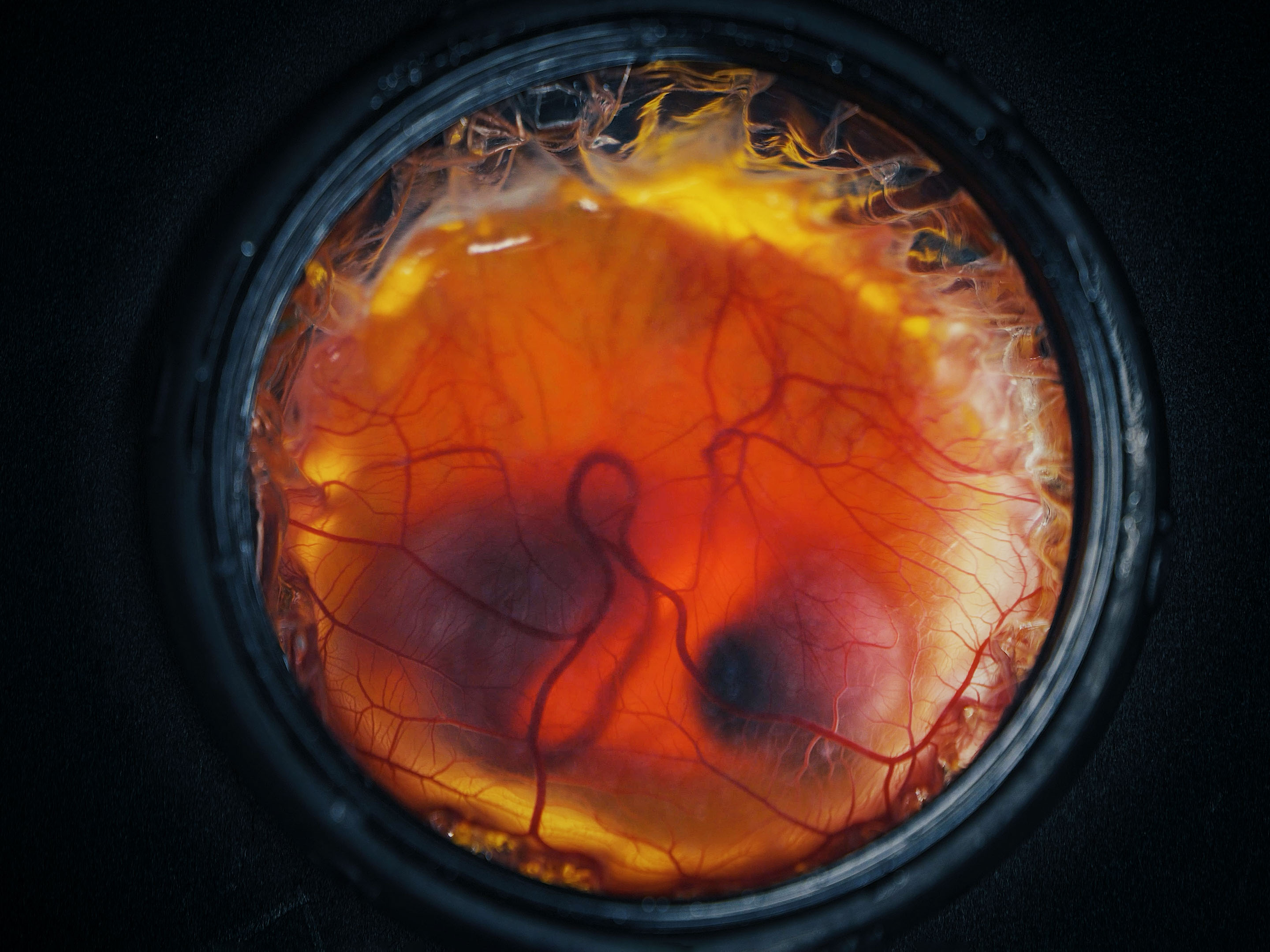 vista hacia el interior de un cascarón de huevo artificial para observar un embrión de pollo en desarrollo y su estructura vascular