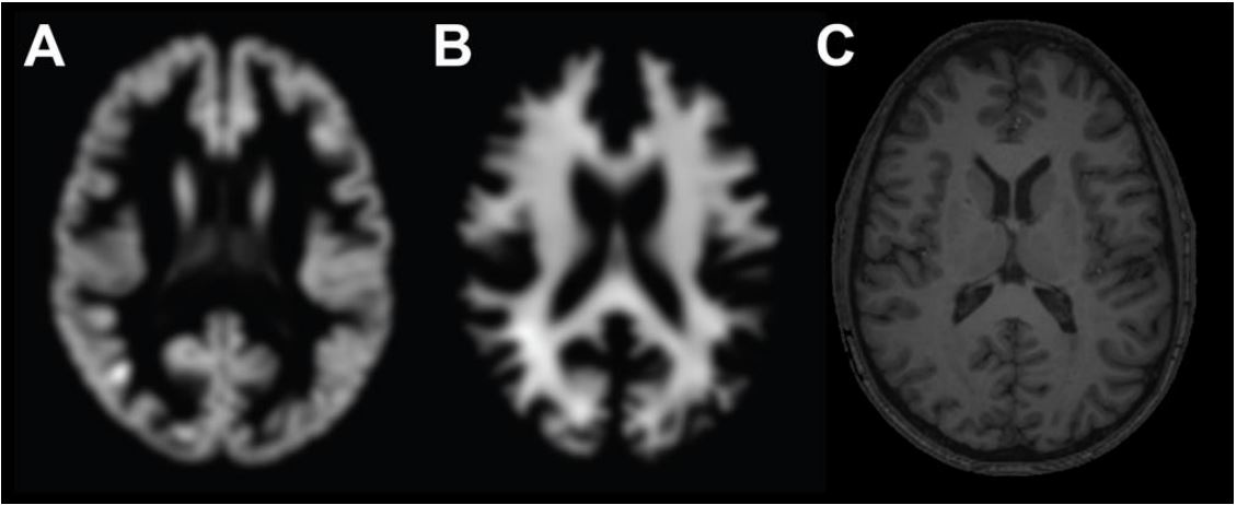 Esta máquina inteligente tarda segundos en averiguar la edad del cerebro