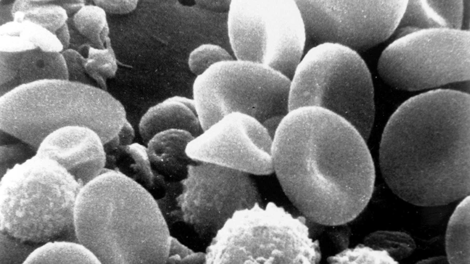 Una proteína podría ser la clave de la eterna juventud que reside en la sangre