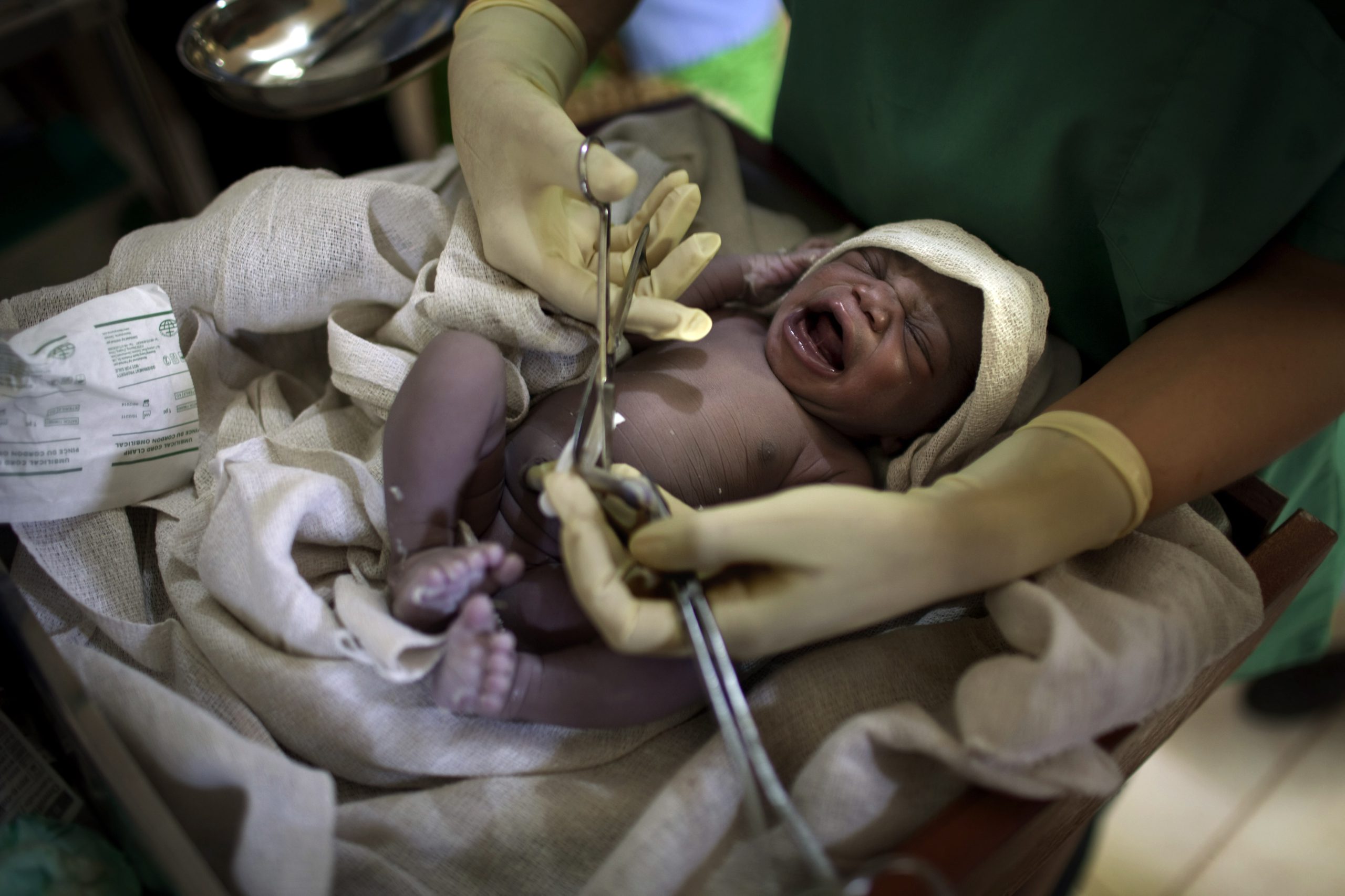 Una proteína del cordón umbilical rejuvenece el cerebro de ratones viejos