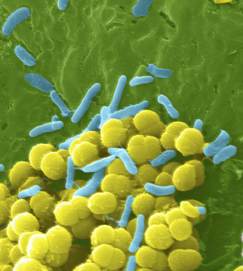 Las bacterias resistentes matarán a 10 millones de personas al año en 2050