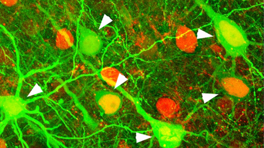 Otro estudio del cerebro intentará que las máquinas aprendan mejor y más rápido