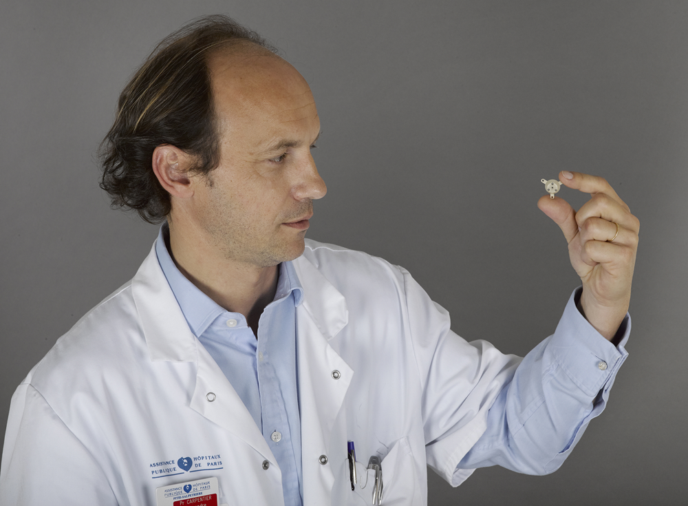 El cáncer cerebral y el alzhéimer tienen un nuevo enemigo: los ultrasonidos