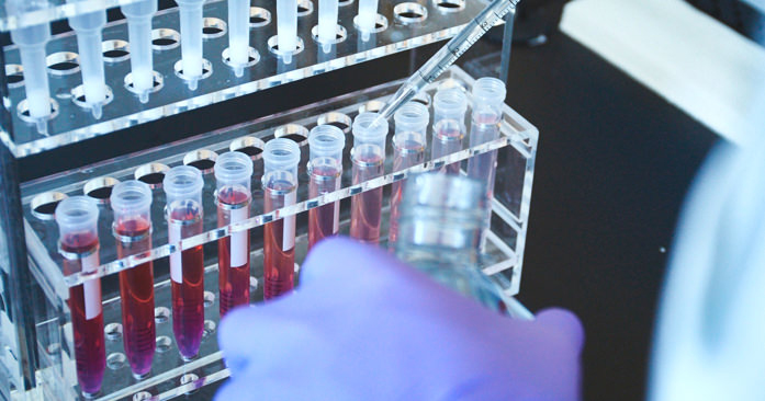 Venden una 'start-up' contra el cáncer por casi 6.000 millones de dólares