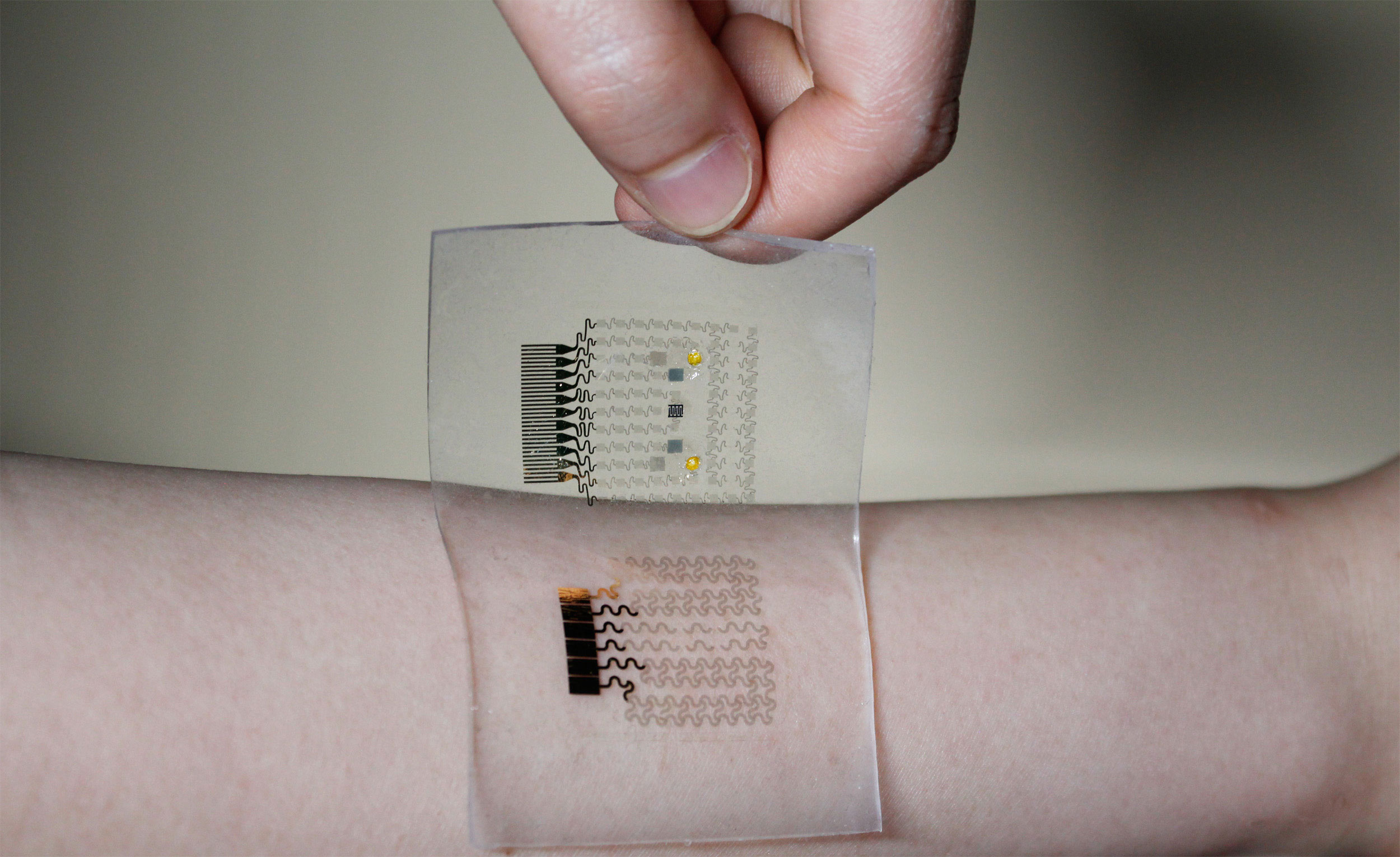 Llega el primer parche que mide y trata de forma automática la diabetes