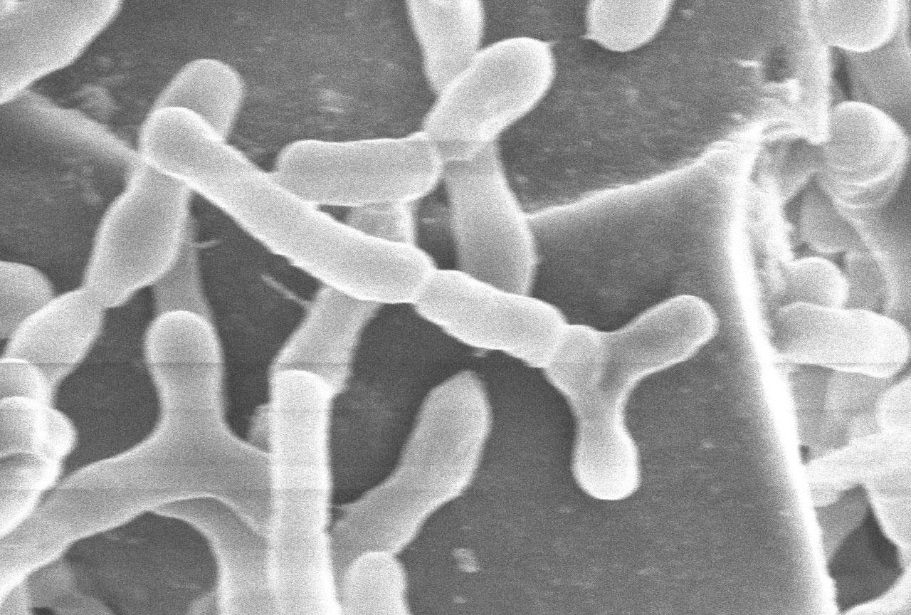 Un fármaco microbiómico contra la inflamación del intestino llega a ensayo