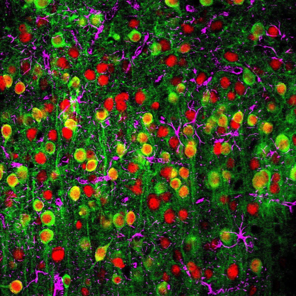 EEUU invierte 60 millones de dólares para enterarse de lo que pasa en el cerebro