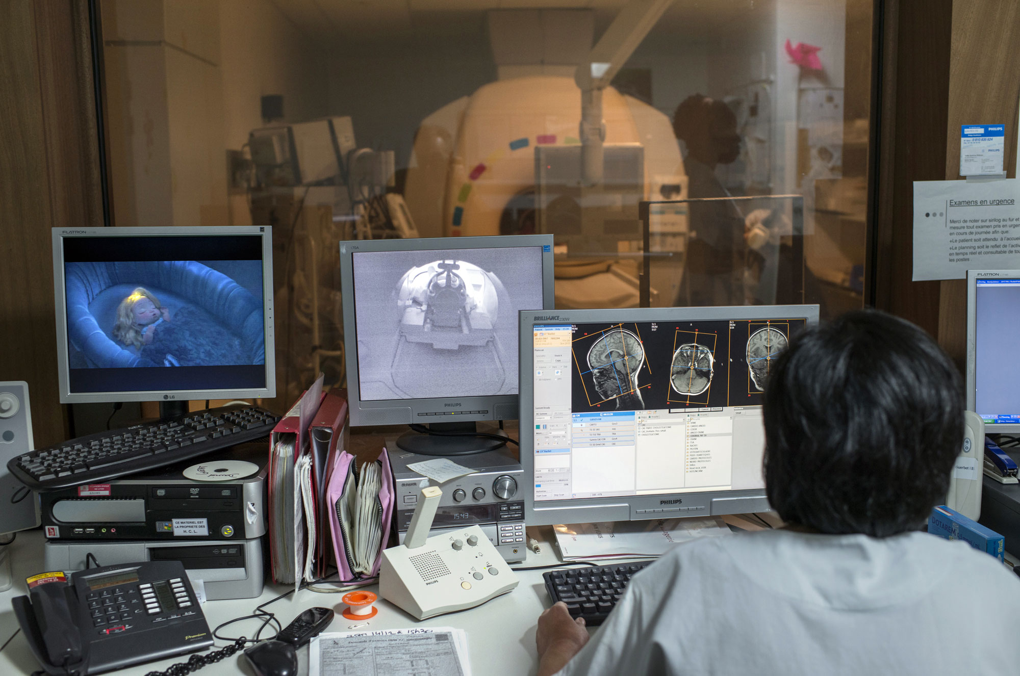 La inteligencia artificial encuentra señales de depresión invisibles para los médicos