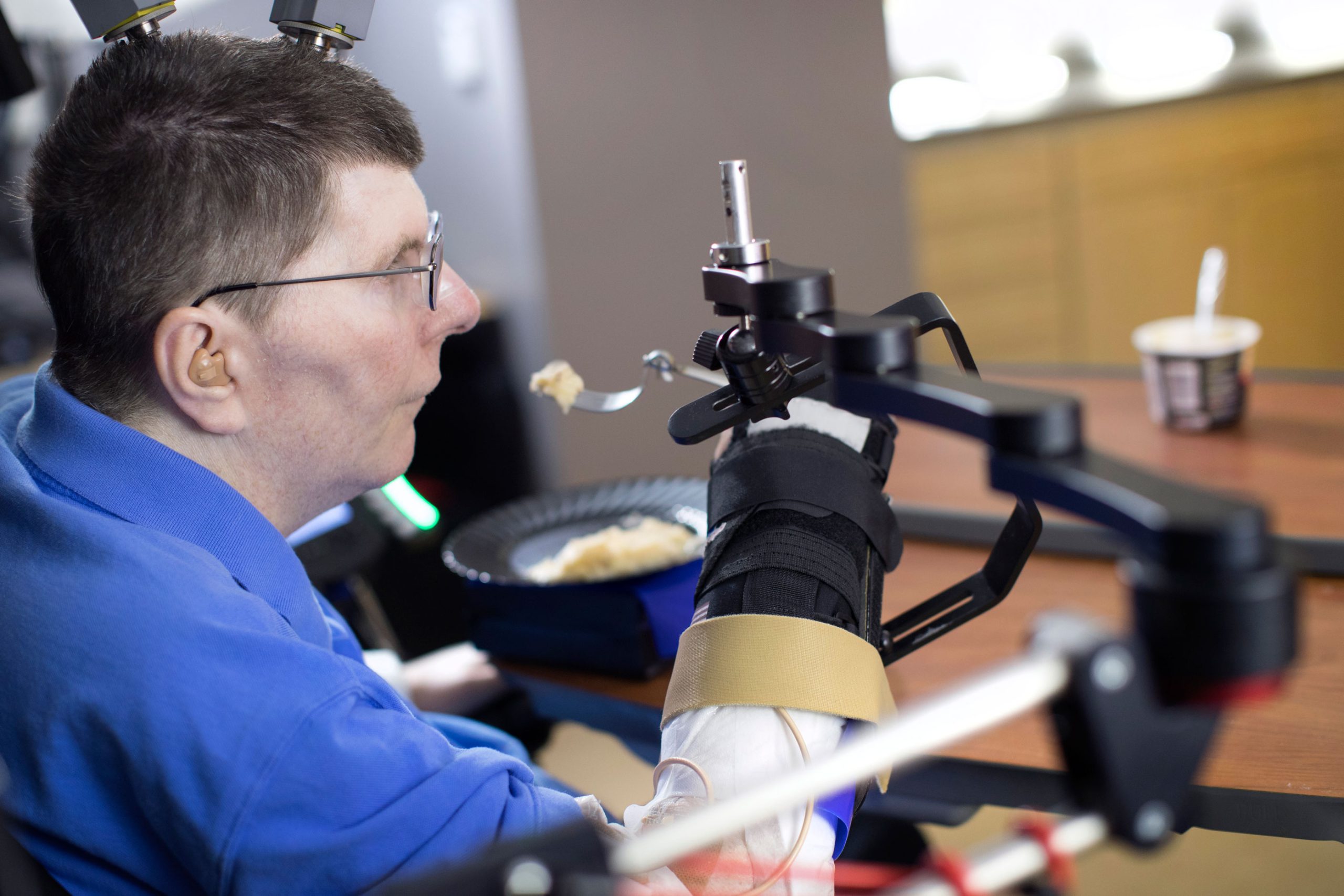 Un tetrapléjico recupera el movimiento de la mano gracias a una neuroprótesis