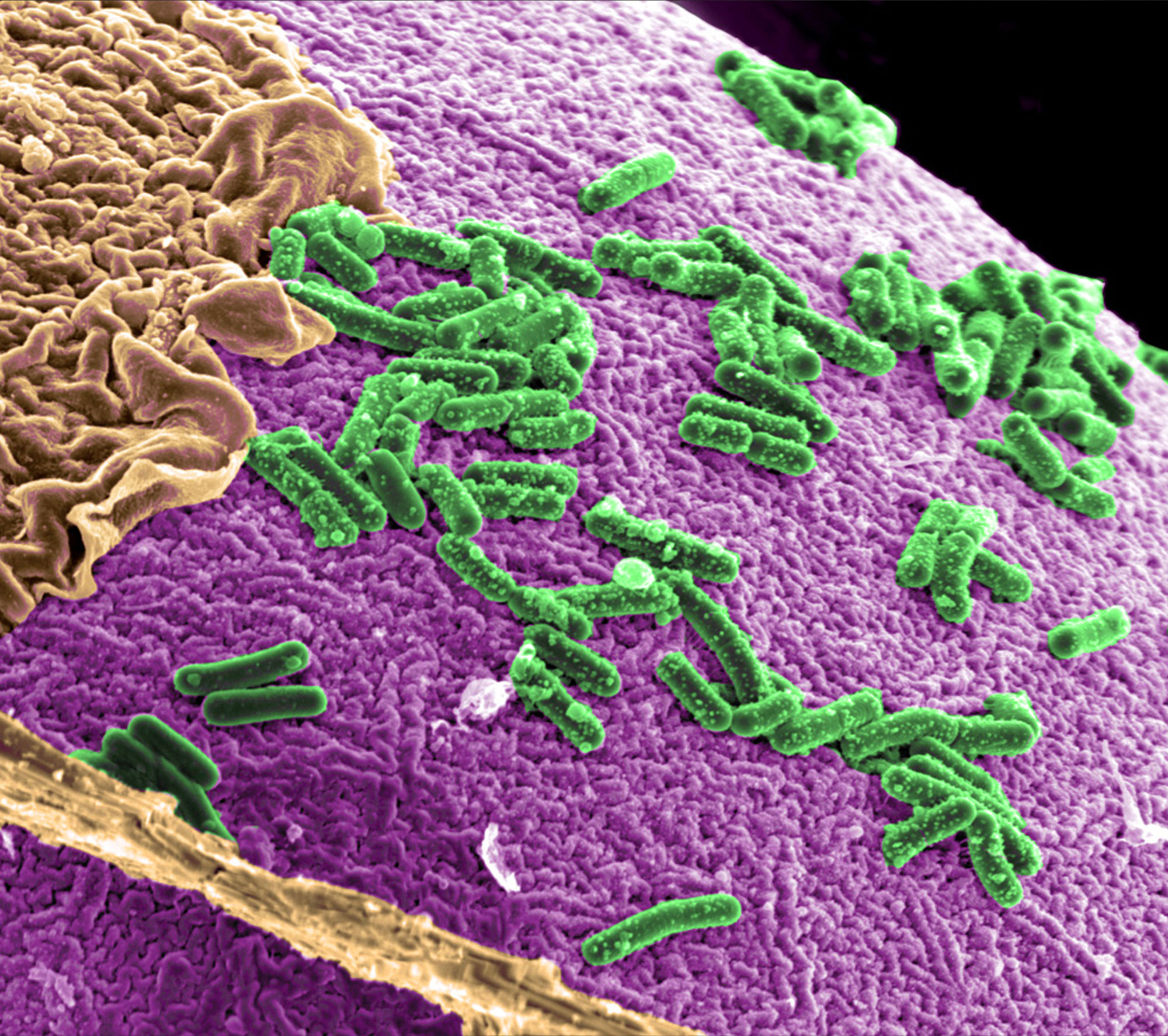 Ya puede secuenciar su microbioma desde casa, pero desconfíe de los resultados