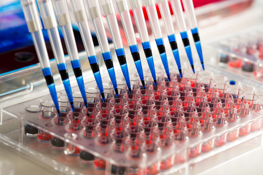 Células inmunes universales (y quizá quimioterapia) curan la leucemia de dos bebés