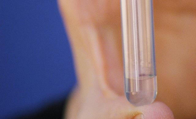 La 'píldora' masculina se acerca con un gel que impide los embarazos en monos