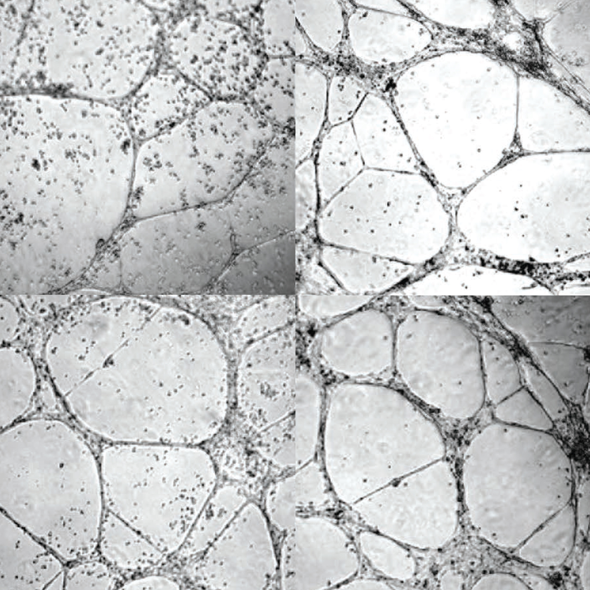 Un gel experimental genera nuevos vasos sanguíneos para ayudar a los diabéticos
