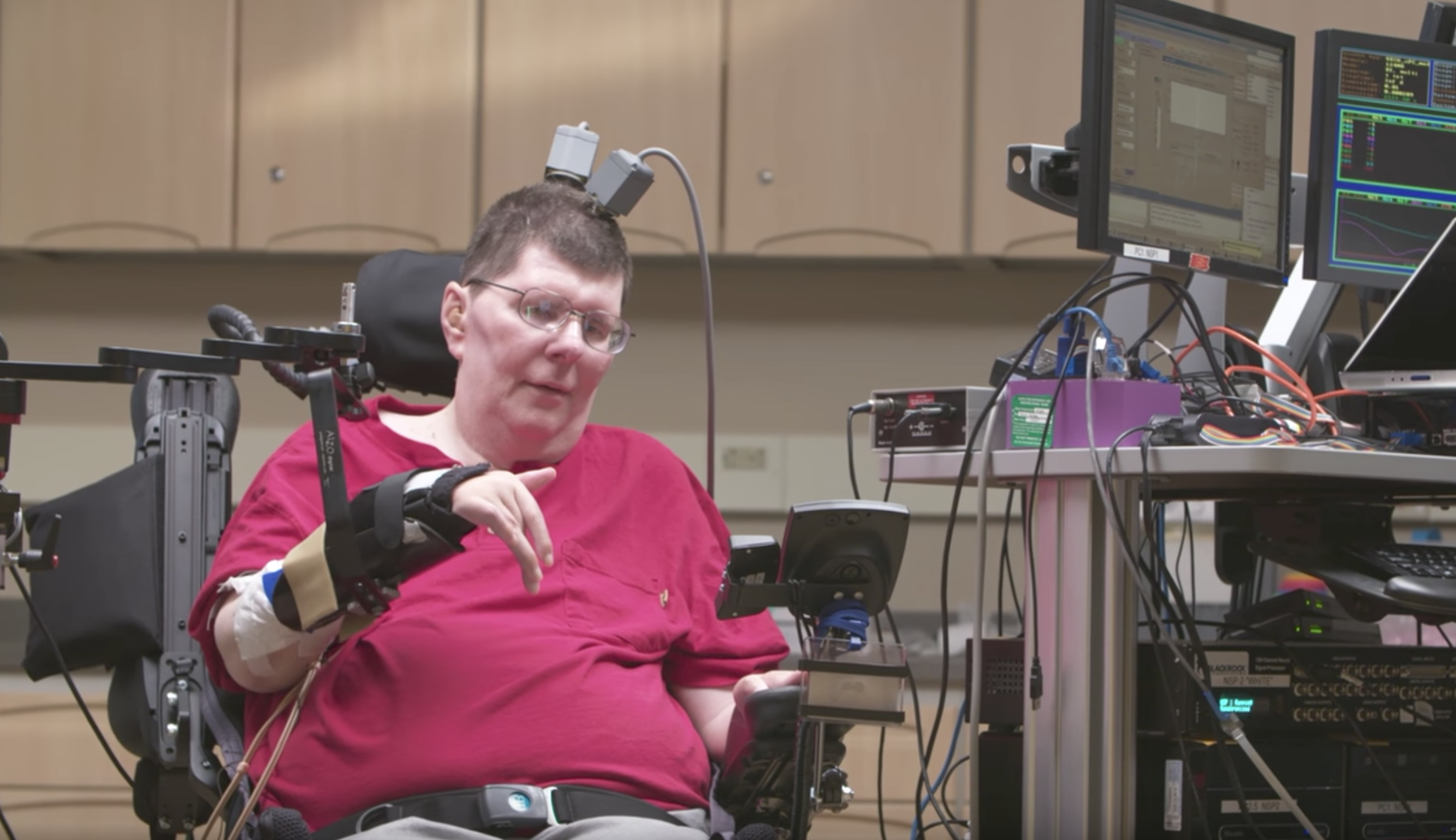 El tamaño y el calor, los desafíos de ARM para colocar chips dentro del cerebro