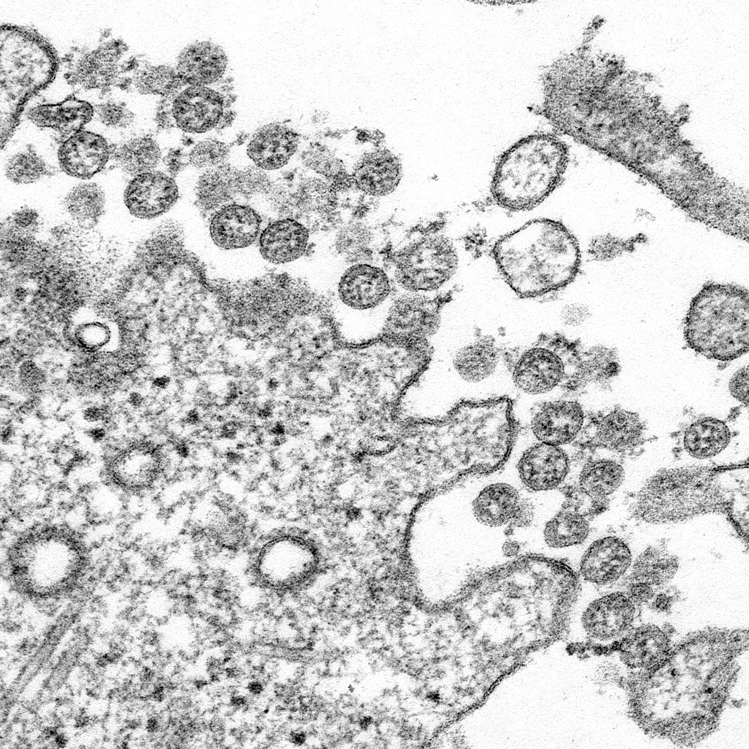 La copia sintética del coronavirus chino que podría acabar con él