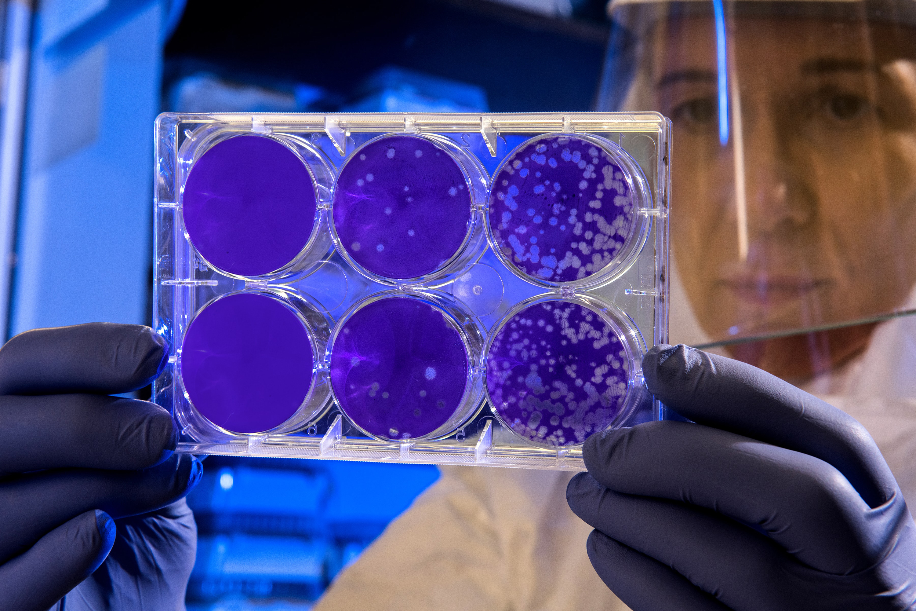 Respuestas a las siete preguntas clave sobre el coronavirus