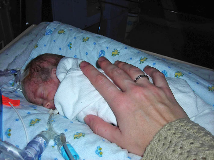 Un análisis de sangre para predecir y salvar a los bebés prematuros