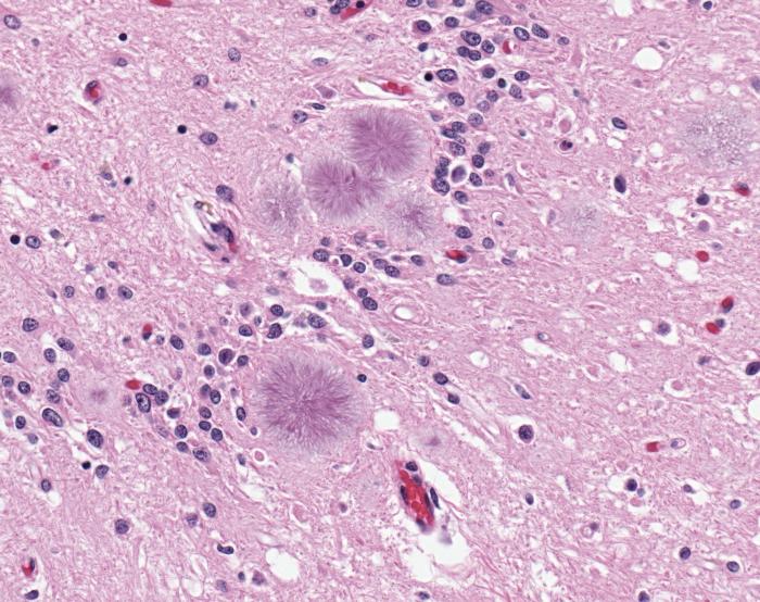 La abogada que se convirtió en científica para curar su mutación mortal