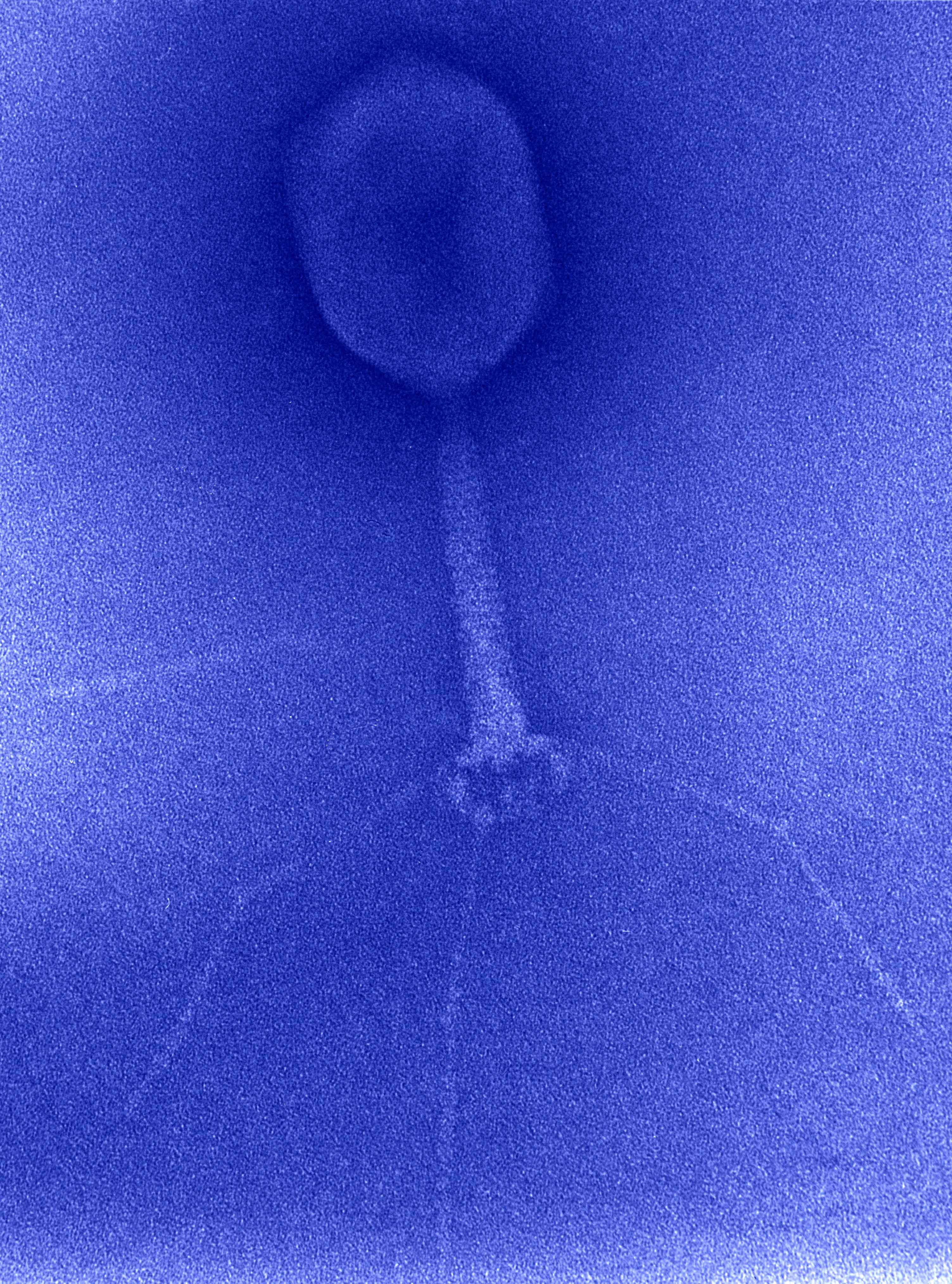 Virus e inteligencia artificial se unen contra las bacterias resistentes