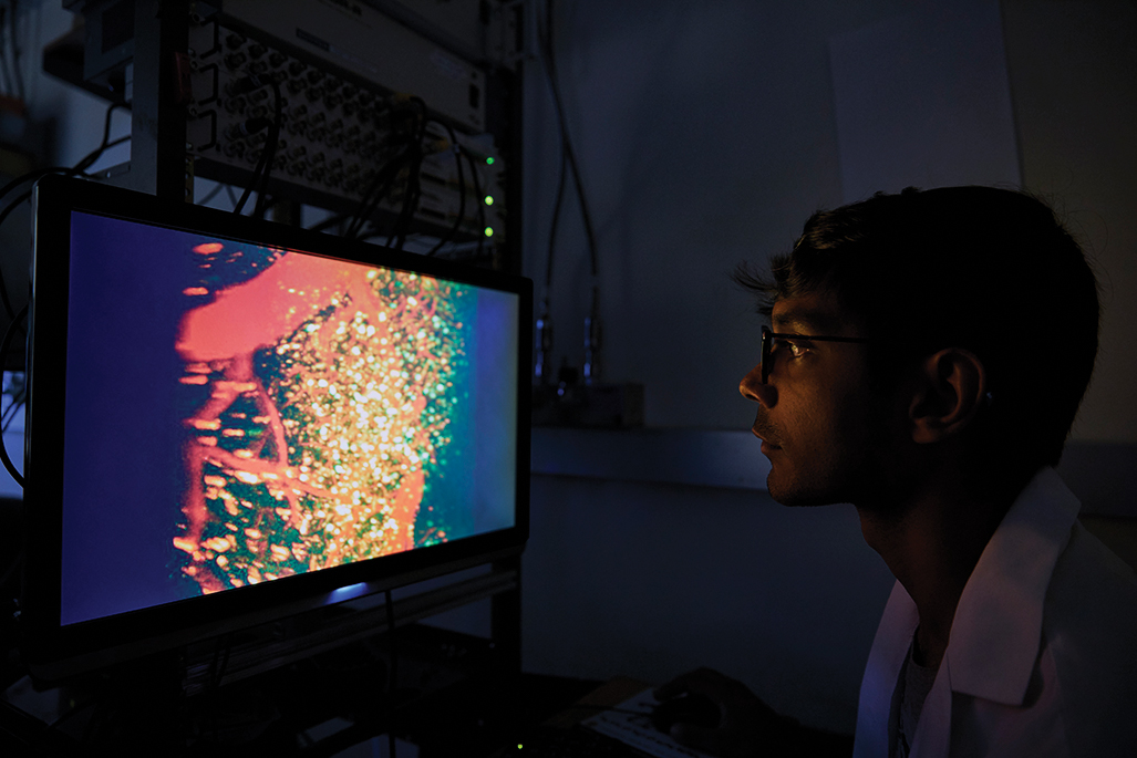 El ejército de científicos que está estudiando un trozo de cerebro del tamaño de un grano de arena