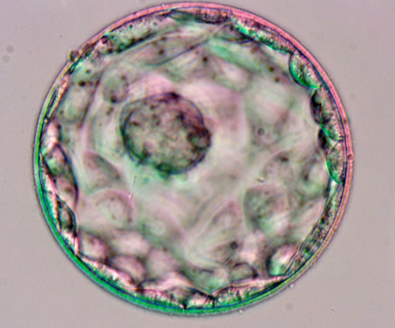 Eugenesia 2.0: los 'bebés a la carta' ya no se crean, se eligen en el laboratorio