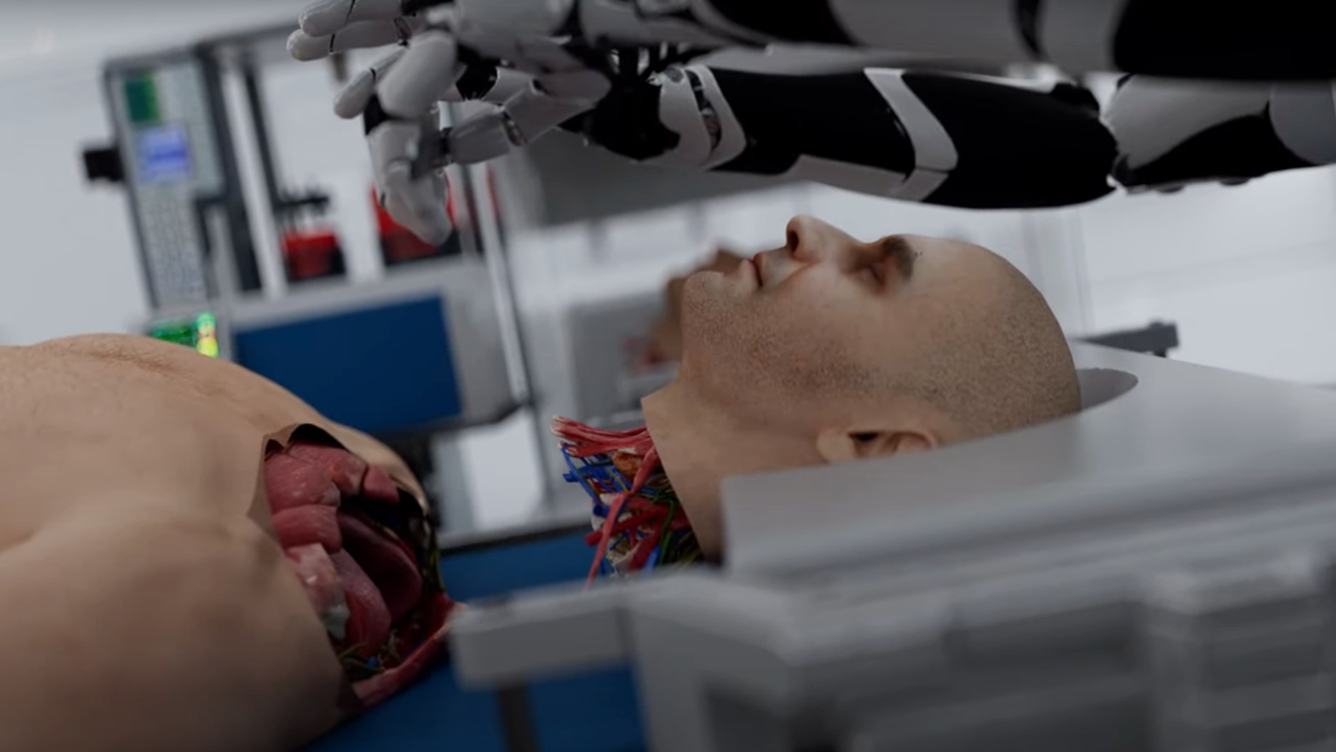 That viral video showing a head transplant is a fake. But it might be real someday