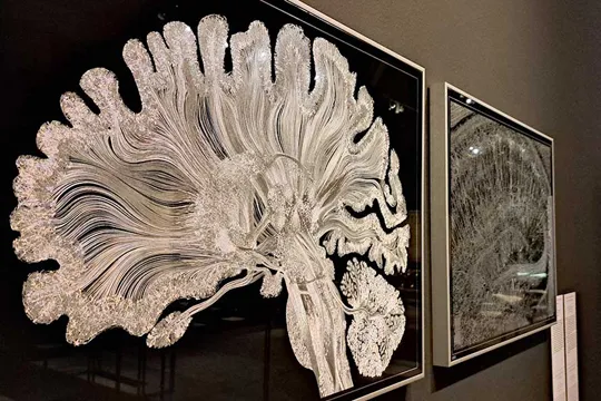 Concepción de la Rúa, Naroa Ibarretxe y JF Martí Massó: "Un análisis del cerebro humano desde la neurociencia"