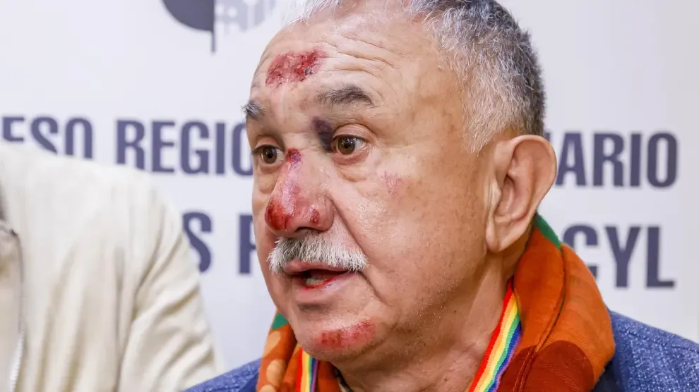 Pepe Álvarez agradece "el cariño" recibido tras su imagen magullado