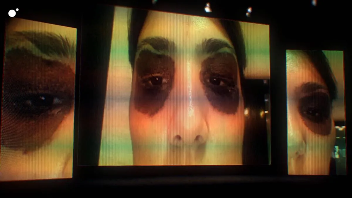 'Microblading', ácido hialurónico... los peligros que esconden estas prácticas cuando se hacen de manera fraudulenta