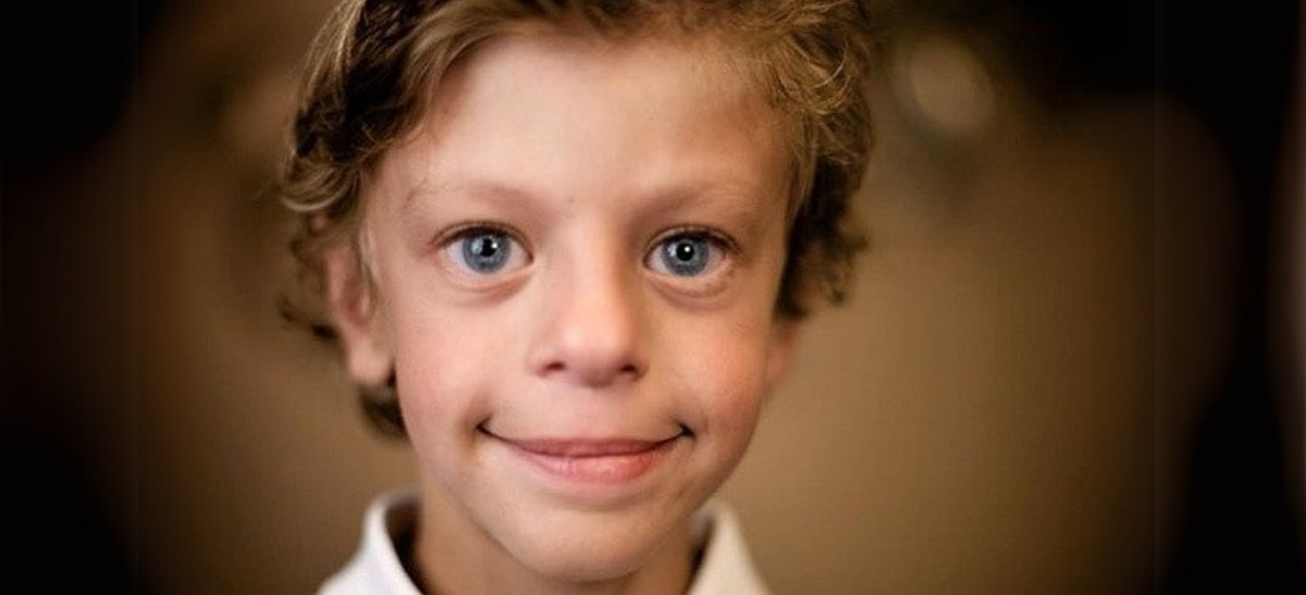 Williams Sendromu Genetikten Sosyal Davranışa Kadar Her Yönüyle